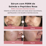 Sérum Rosa PDRN e Peptídeos