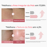Soro Shot PDRN Colágeno Rosa – Elasticidade e Glow
