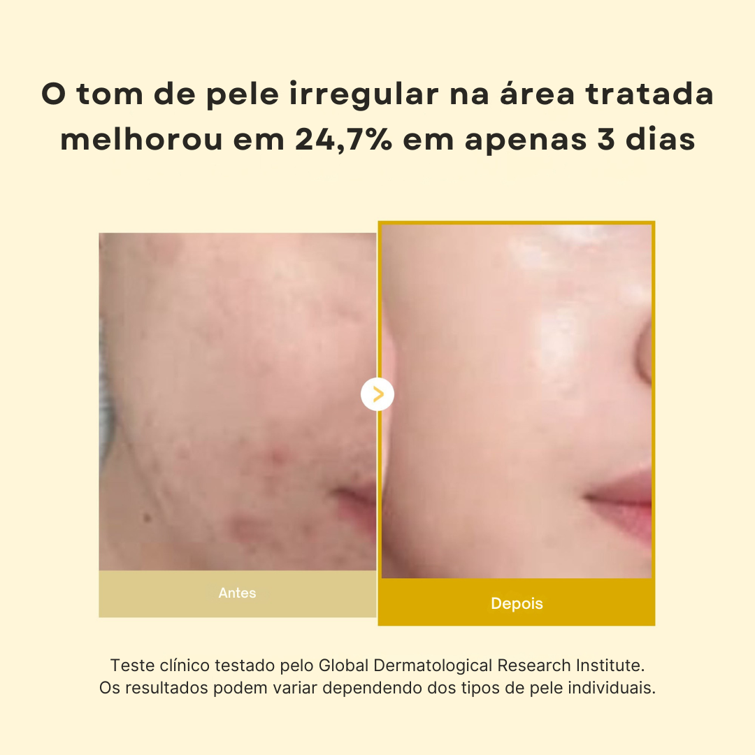 Cuidados noturnos com cúrcuma e colágeno